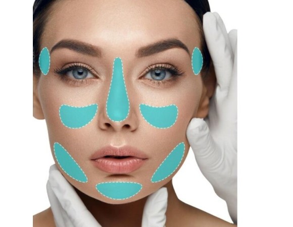 YouthFill Shape филлер с лидокаином 1 мл img 3