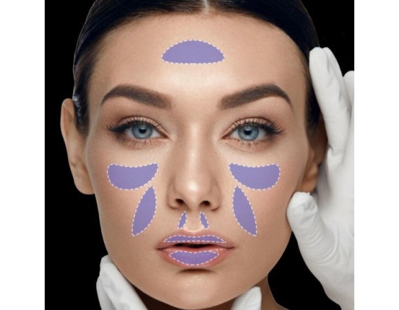 YouthFill Deep филлер с лидокаином 1,1 мл img 3