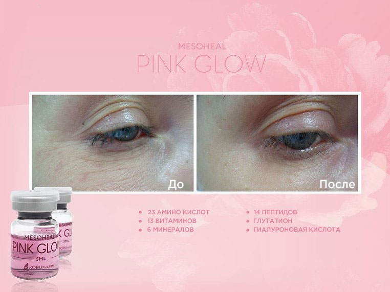 Mesoheal Pink Glow - склад і результат препарату ✔️ Краща ціна | Filler-Shop